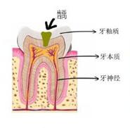 牙齿上有黑点是什么需要治疗吗