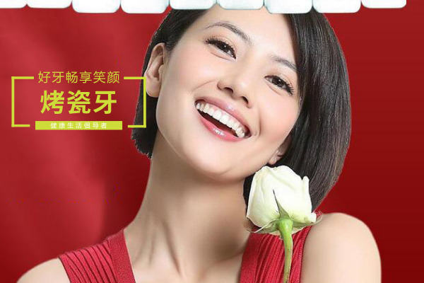成都烤瓷牙牙套价格表