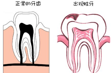 成都圣贝牙科医院补牙要多少钱