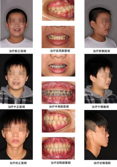 成都有哪些好的牙科医院