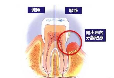 成都治疗龋齿那个好